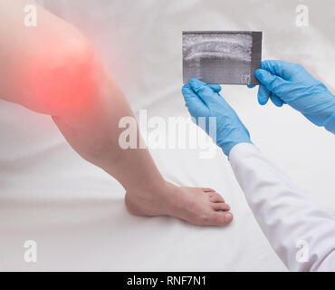 Arzt Orthopäde hält einen Ultraschall Bild einer Frau, die hat ein wundes Knie. Gonarthrose, Arthritis, Nahaufnahme, Kopie, Bursitis Stockfoto