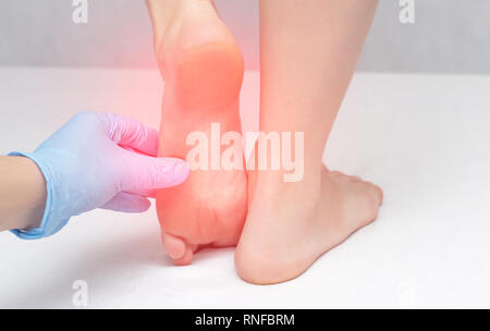 Der Arzt untersucht den Patienten s Füße für Mykosen und Hühneraugen, rissige Fersen, medizinische, onychomycosis Stockfoto