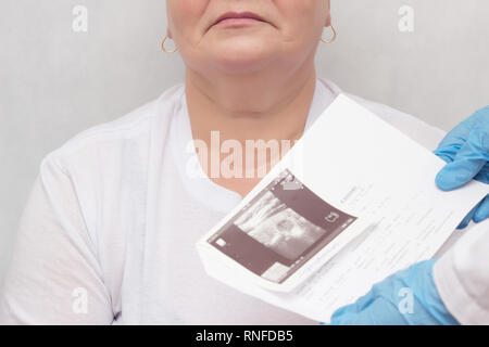 Eine Frau durch ein endocrinologist, Schilddrüsenhormone konsultiert wird, der Arzt hält ein Ultraschallbild, weißer Hintergrund, Endokrinologie Stockfoto