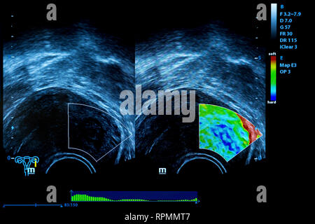 Buntes Bild der modernen Ultraschall-Monitor. Ultraschallgerät. High-Tech-Medizin und Gesundheit-Ausrüstung. Ultraschall-Bildgebung oder sonogra Stockfoto