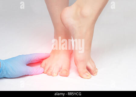 Arzt untersucht Sie die Füße des Patienten auf das Vorhandensein von Pilz und Risse auf den Fersen, weißer Hintergrund, Nahaufnahme, Problem Stockfoto