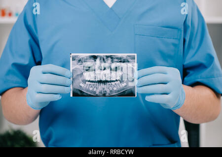 7/8-Ansicht von Kieferorthopäden holding Zähne x-ray in der Klinik Stockfoto