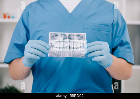 7/8-Ansicht von Kieferorthopäden holding Zähne x-ray in der Klinik Stockfoto