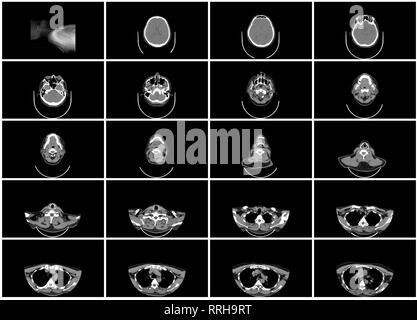 Ct-scan Schritt Einstellen der oberen Hals axiale Ansicht von oben Stockfoto