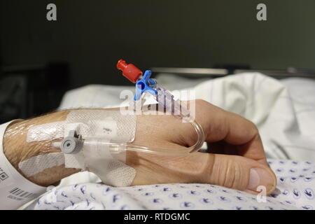 Eine Katheterisierung der Arm des Patienten, Klinik Siloah, Hannover, Deutschland. Stockfoto