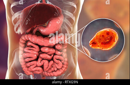 Balantidiasis, konzeptionelle Bild. Computer Abbildung in der Nähe zeigt der Ciliate Protozoen Balantidium coli, eine intestinale Parasiten die causati Stockfoto