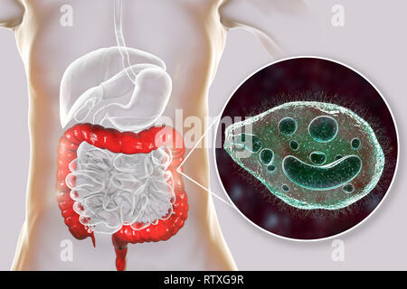 Balantidiasis, konzeptionelle Bild. Computer Abbildung in der Nähe zeigt der Ciliate Protozoen Balantidium coli, eine intestinale Parasiten die causati Stockfoto