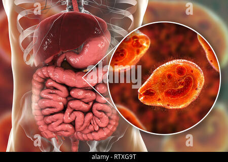 Balantidiasis, konzeptionelle Bild. Computer Abbildung in der Nähe zeigt der Ciliate Protozoen Balantidium coli, eine intestinale Parasiten die causati Stockfoto