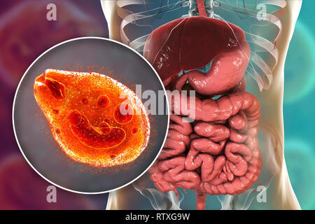 Balantidiasis, konzeptionelle Bild. Computer Abbildung in der Nähe zeigt der Ciliate Protozoen Balantidium coli, eine intestinale Parasiten die causati Stockfoto