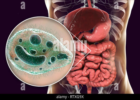 Balantidiasis, konzeptionelle Bild. Computer Abbildung in der Nähe zeigt der Ciliate Protozoen Balantidium coli, eine intestinale Parasiten die causati Stockfoto