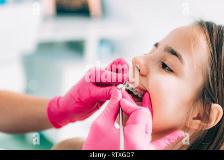 Kieferorthopäden zur Festsetzung Zahnspangen Girl's. Stockfoto