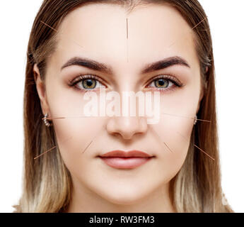 Junge weibliche Gesicht mit gesteckten Nadeln. Die Frau, die sich einer Akupunkturbehandlung Stockfoto