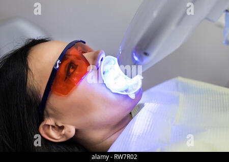 Laser Zahnaufhellung bei dantist Zimmer. Zähne, die für die Frau. Bleichen der Zähne beim Zahnarzt Klinik. Stockfoto