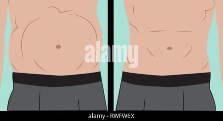 Abdominalen Blähungen Vector Illustration Stock Vektor