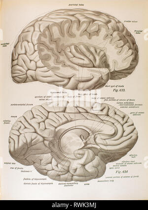 Dissektion des menschlichen Gehirns, zeitliche und Scheitellappen. Stockfoto