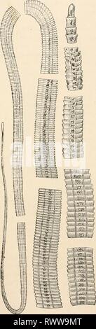 Elementare Lehrbuch der Zoologie (1884) Elementare Lehrbuch der Zoologie elementarytextbo 0101 clau Jahr: 1884 336 YERMES. hat eine sehr unregelmäßige Form; während die Form, die bewohnt, Haustieren, E. soolicipariens, häufiger behält die Form des einfachen Vesikel. Schließlich Diese echinococcus Zysten häufig bleiben steril, in welchem Fall Sie Acephaloct/sts genannt werden. Und in der Tat pathologische Form ist die so genannte multilocular Ecldnococcus., die sich seit langer Zeit für ein Kolloid Krebs genommen wurde. Es ist auch in Mammalia (bei Rindern) gefunden, und hier stellt sich eine verwirrende re-Schein Stockfoto