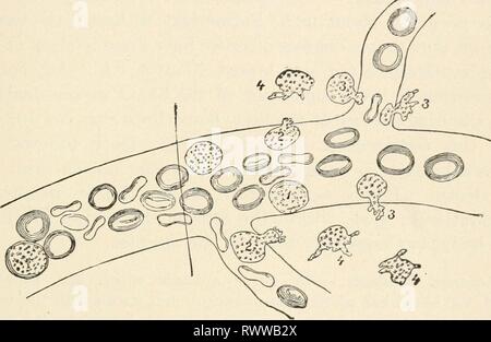 Elemente der Biologie; eine praktische Elemente der Biologie; ein praktisches Lehrbuch Korrelation von Botanik, Zoologie, und die menschliche Physiologie elementsofbiolog 00 Jagd Jahr: [1907] DAS BLUT 347 Sie füttern durch Versenken ihre Beute. Diese Tatsache hat einen sehr wichtigen Einfluss auf das Verhältnis der farblosen Blutkörperchen zu bestimmten Krankheiten, die durch Bakterien im Körper verursacht. Wenn, zum Beispiel, ein Schnitt, wird durch Bakterien infiziert, Entzündung kann in eingerichtet. Die Bakterien bilden ein Gift als Toxin, die diese Entzündung in Ihrer unmittelbaren Nachbarschaft Ursachen bekannt. Farblos Blutkörperchen auf einmal sur-Runde Ort und Angriff auf die Stockfoto