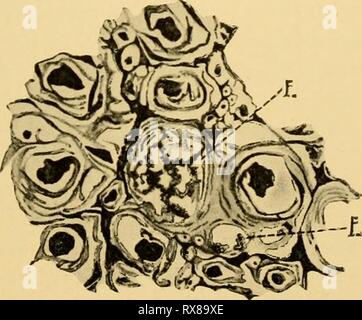 Die Auswirkungen der inanition und die Auswirkungen der inanition und Unterernährung auf Wachstum und Struktur effectsofinaniti 00 Jack Jahr: 1925 Abb. 63. - Nervenzellen aus dem ventralen Horn des Rückenmarks in Vögeln (Giemsa Blut Fleck). Der Nukleus, n, ist in jedem angegeben, eine, die von der normalen Tier, Anzeigen Nissl Organe; b, c, Zellen von Geflügel mit polyneuritis (beriberi) nach 24 Tagen auf poliertem Reis Diät. Der Kern ist Degeneriert; die Nissl Gremien haben sich aufgelöst, und die stainable Stoff wird in unregelmäßigen Massen auf der einen Seite der Zelle gesammelt. (Vedder und Clark" 12.) Abb. 64.- ein Teil des Stockfoto