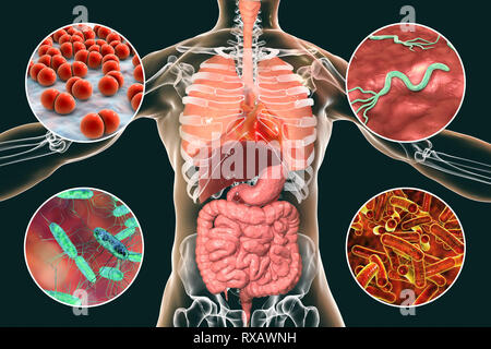 Bakterien, die Infektionen beim Menschen verursachen, Abbildung Stockfoto