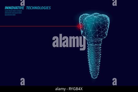 Zahn Low Poly Medizin Konzept der Implantation. Stomatologie innovation Technologie zahnmedizinische Banner-vorlage Vektor illutration Stock Vektor