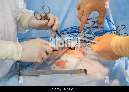 Chirurgie auf dem Abdomen Stockfoto