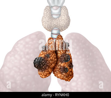 Thymus Krebs oder Thymoma und thymus Karzinom Krankheit als eine Drüse Anatomie Krankheit mit bösartig wachsenden mutierende Zellwachstum als Symbol isoliert. Stockfoto