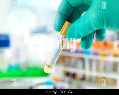 Arzt Vorbereiten einer HIV Test Probe für die Prüfung im Labor. Stockfoto