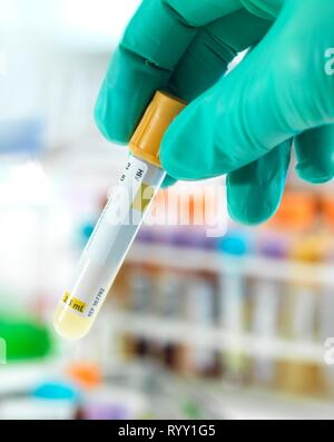 Arzt Vorbereiten einer HIV Test Probe für die Prüfung im Labor. Stockfoto