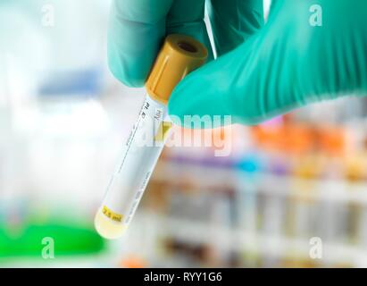 Arzt Vorbereiten einer HIV Test Probe für die Prüfung im Labor. Stockfoto