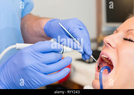 Entfernen der zahnmedizinischen Zahnstein. Stockfoto