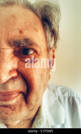 87 - Jahre alter Mann mit Typ 2 diabetes Stockfoto