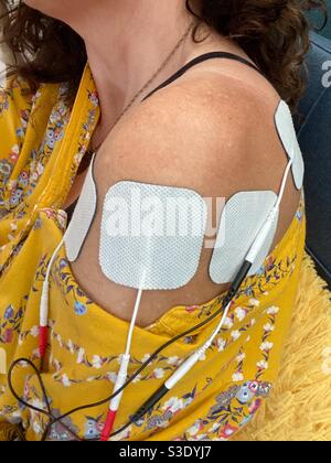 Eine Frau, die transkutane elektrische Nervenstimulation bei einer Schulterverletzung verwendet. Stockfoto