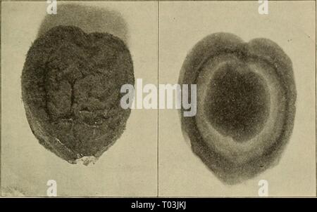 Elementare Botanik. elementarybotany 00 atki Jahr: 1898 weitere Studien über die GYMNOSPERMS. 215 entwickelt vollständig innerhalb der macrosporangium, und leitet daraus die Nährstoffe für das Wachstum von der cycas Werk, das ist das Bild. 279. Macrosporangium ot Cycas revoluta Abb. 280. Röntgen Fotografie des Gleichen, show-ing weibliche prothallium. sporophyt. Archegonia sind in diesem internen Masse von Zellen entwickelt. Diese hilft uns in Schrecken - Bergbau, daß es die prothal - lium. In cycas ist auch Endosperm genannt, ebenso wie in den Kiefern. 430. Wenn wir schneiden Sie eines der reifen Eizellen, sehen wir die en-dosperm (Prot. Stockfoto