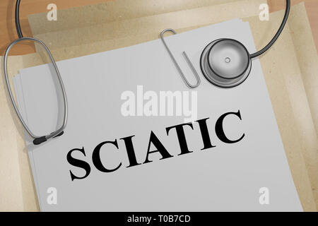 3D-Darstellung des Ischiasnervs Titel auf ein medizinisches Dokument Stockfoto