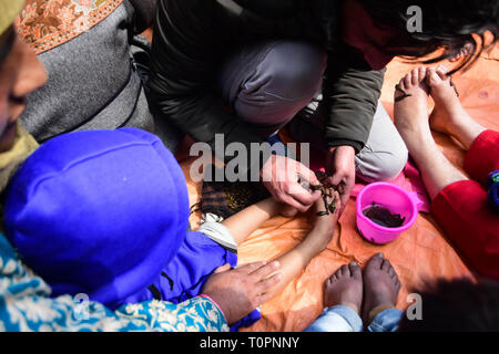 Kaschmirischen Volkes nehmen Blutegel Behandlung am Dal Lake Srinagar, Indien verwalteten Kaschmir am 21. März 2019. 21 Mär, 2019. Die traditionelle Behandlung wird jedes Jahr am Tag der Nauroz Tag (Iranische auf das Neue Jahr gehalten). Die Heiler mit Blutegel das Unreine Blut von Patienten, die Haut, kalt oder Frost Krankheiten zu saugen. Credit: Muzamil Mattoo/IMAGESLIVE/ZUMA Draht/Alamy leben Nachrichten Stockfoto