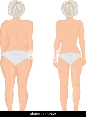 Fett und Slim's Mädchen zurück. Fat thig. Fettabsaugung. Vor und Nach. Frau Body Correction Vector Illustration Stock Vektor