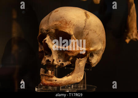 Schädel eines Master Gunner (auf der Basis von Objekten mit Ihm gefunden) in der Mary Rose Museum, Portsmouth Historic Dockyard, Großbritannien Stockfoto