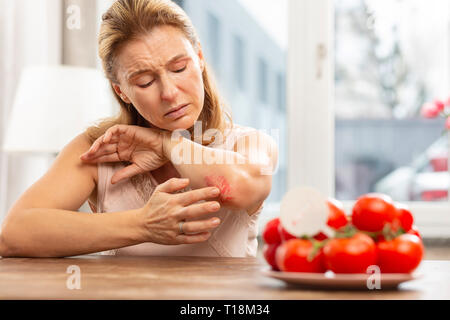 Frau mit Hautausschlag und Kratzer am Knie, weil der Allergie Stockfoto