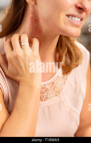 Blonde Frau Gefühl schrecklich mit Hautausschlag und Rötung am Hals Stockfoto