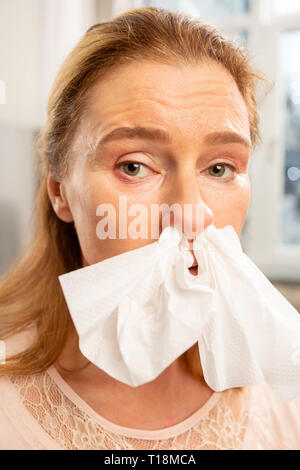 Grünäugige Frau mit Allergie in Serviette an ihre Nase Stockfoto