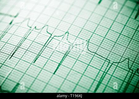 Nahaufnahme von einem Elektrokardiogramm in Papierform. Stockfoto