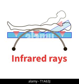 Person liegt auf dem Physiotherapie Bett. Zwei Positionen an der Rückseite der Infrarot Massageliege helfen, den besten therapeutischen Effekt zu erzielen. Rückenmark extru Stock Vektor