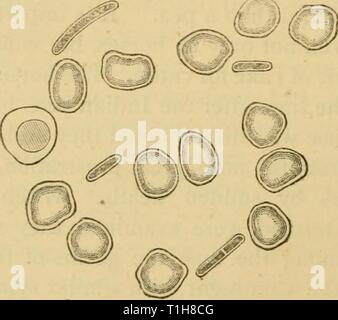 Krankheiten & Störungen der Krankheiten & Beschwerden des Pferdes: Eine Abhandlung über equine Medizin und Chirurgie diseasesdisorder 00 gres Jahr: 1886 Herz Blut eines toten jMouse von Milzbrand. 1. Blut - Discs. "2. "Hite Blut - korpuskel. 3. Bazillen anthracis. INIagnifying Power 700. (Frisches Exemplar.) nach Klein. Blut eines Guinea-pig Tot der symptomatischen Anthrax. Blut - blutkörperchen und zwischen ihnen mehrere Bazillen. Ingnifying Power 700. (Gefärbt mit Spiller's Lila.) nach Klein. Stockfoto