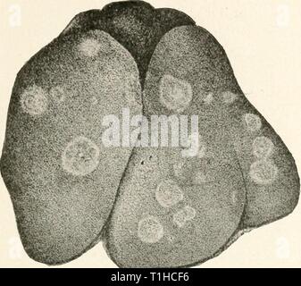 Die Krankheiten von Geflügel (1899) die Krankheiten des Geflügels diseasesofpoultr 00 salmrich Jahr: 1899 KRANKHEITEN DES GEFLÜGELS 107 Bild'. 20.- Leber erkrankter Türkei. ance und ist abgeflacht oder sogar leicht gedrückt unter der Oberfläche. Die Leber kann nur wenige oder manj - dieser Zentren der Krankheit, die, wenn sie über Cut gefunden sind tief in das Gewebe der orsan eingebettet zu sein und im Allgemeinen eine sphärische Form zu haben. Gelegentlich die Läsionen sind sehr umfangreich und der Tod des großen por- tionen des Lebergewebes folgt. Caus. tion. - Die Krankheit wird von einem der Protozoen, das Smith die genannten verursacht hat, Stockfoto