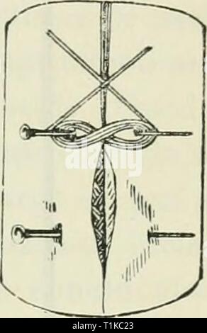 Die Krankheiten und Störungen der Krankheiten und Störungen des Ochsen, mit Berücksichtigung der Krankheiten der Schafe diseasesdisorderox 00 gres Jahr: 1889 Abb. 79. - Twisted Naht. Die unterbrochene Naht Sie, indem Sie separate Threads oder Seide, oder Kabel durch die Lippen der Wunde gebildet. Für den Fall, dass ein Thread oder eine doppelte und gewachst Stück Seide verwendet wird, die Naht ist gebunden, während bei Kabel beschäftigt ist es verdreht ist. Die Masche ist in Abständen von etwa 3 cm wiederholt werden, und es sollten weitergegeben werden Stockfoto