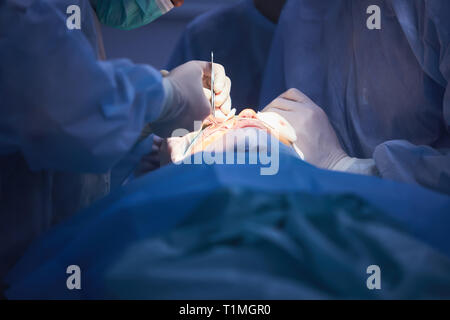 Op-Team bei Operationen in der modernen Betrieb Theater, Team von Ärzten die Konzentration auf einen Patienten während einer Operation, Team von Ärzten Stockfoto