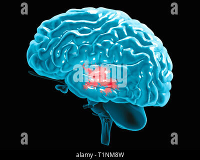 Abschnitt eines Gehirns im Profil gesehen, Teile des Gehirns. Degenerative Erkrankungen, Parkinson, Synapsen, Neuronen, Alzheimer Stockfoto