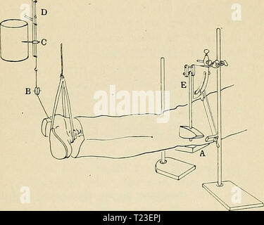 Archiv Bild ab Seite 160 von Richtungen, die für die Arbeit im Labor in Richtungen für die Arbeit im Labor in der Physiologie für die Verwendung von Medizinstudenten directionsforlab 00 lomb Jahr: 1914 THU KNKE - JF. RK. 131 Mitte der Schlagfläche wird nur die Haut berühren über der Mitte des ligamentum patellae, so dass der Schlag wird im rechten Winkel zum Ligament angeschlagen werden. Ordiiiarv Kleidung wird nicht mit Ergebnisse beeinträchtigen. Diese Einstellung mit großer Sorgfalt machen, dann spannen Sie die Stange Unterstützung der Hammer. Abb. 28. Methode der Unterstützung von Hüfte und Fuß und der Aufnahme das Schwingen der das Bein im Knie - Stockfoto