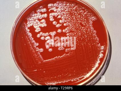 Nahaufnahme der Agar platte Bacillus anthracis Kultur wachsenden Kolonien, die ätiologischen Erreger von Milzbrand, 1975. Bild mit freundlicher Genehmigung Zentren für Krankheitskontrolle und Prävention (CDC). () Stockfoto