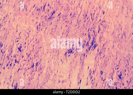 Holz Muster der karelischen Birke, Hintergrund Foto Textur. Verschiedene Farben und Schattierungen Stockfoto